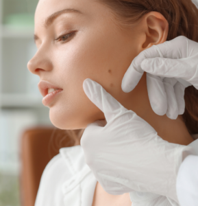 A woman gets a mole on her face examined